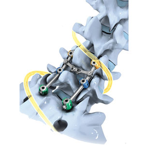 lumbo-sacral osteosynthesis unit