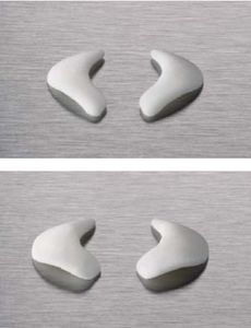 nasal implant