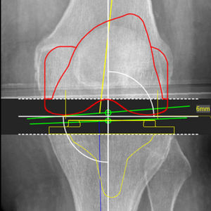 orthopedic software