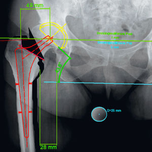 orthopedic software