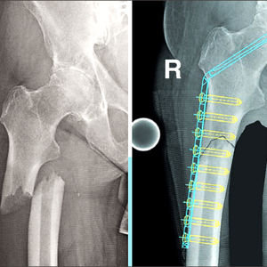 orthopedic software