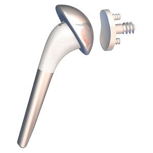 cementless shoulder prosthesis