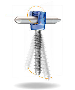 lumbar pedicle screw