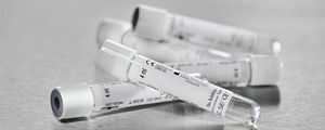 laboratory collection tube 1