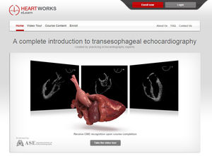 echocardiography software