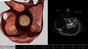 echocardiography software module