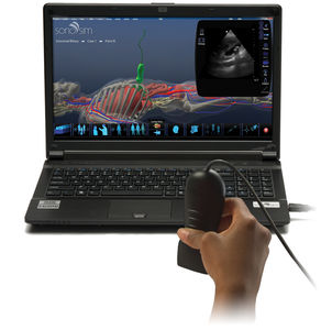 ultrasound imaging simulator