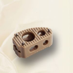thoraco-lumbar interbody fusion cage 1