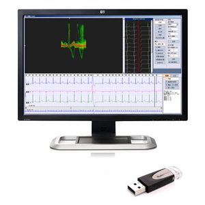 ECG software