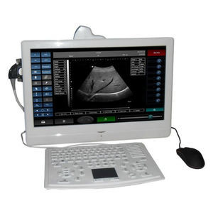 on-platform, tabletop ultrasound system