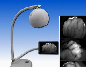 infrared vein finder 1