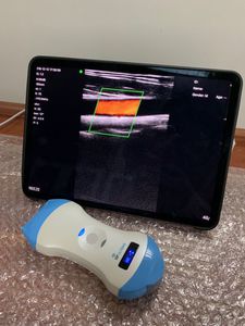 hand-held ultrasound system 1