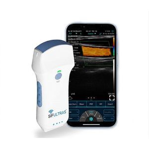 convex-array ultrasound transducer 1