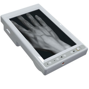 infrared vein finder