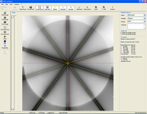 radiation therapy software