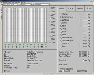 radiation therapy software