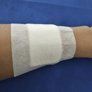 antimicrobial wound dressing