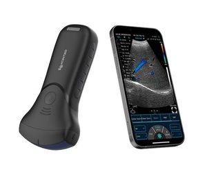 convex-array ultrasound transducer