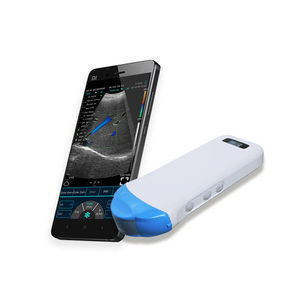microconvex-array ultrasound transducer
