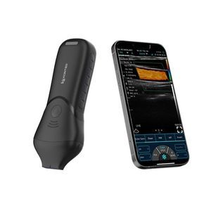 linear-array ultrasound transducer
