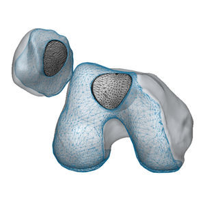 primary patello-femoral prosthesis