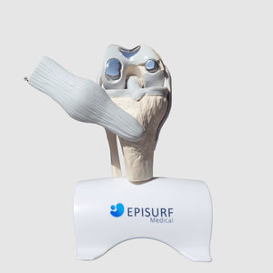 knee implant