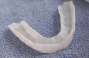 bruxism mouthguard