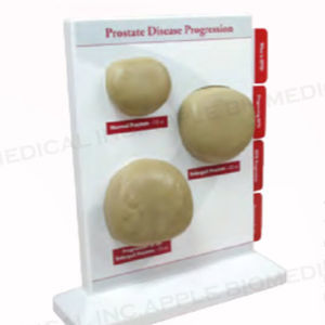 prostate model