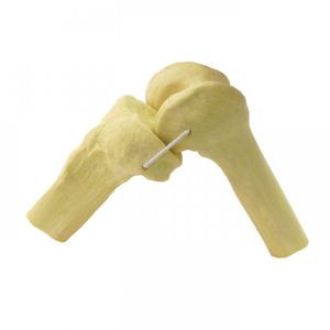 knee model
