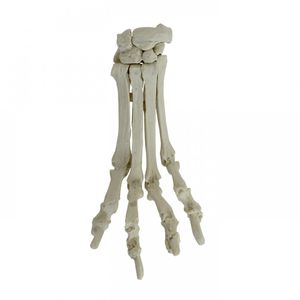 metacarpal anatomical model 1