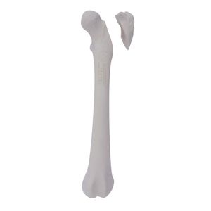 femur anatomical model 1
