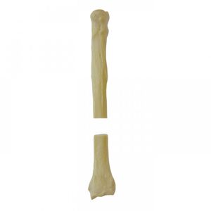 radius anatomical model 1