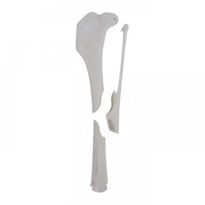 tibia anatomical model 1