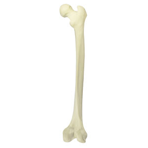 bone model 1