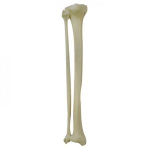bone model 1