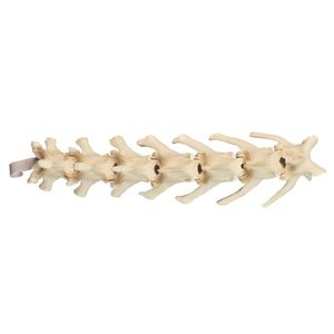 lumbar vertebral column model 1