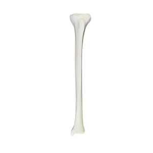 bone model 1