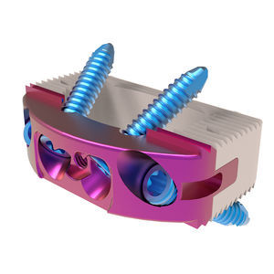 thoraco-lumbar interbody fusion cage