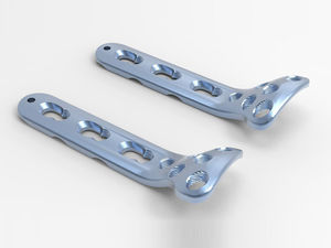 radius compression plate