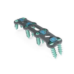 cervical arthrodesis plate 1