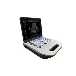 portable ultrasound system