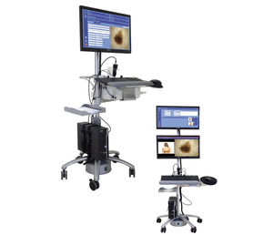 video dermatoscope