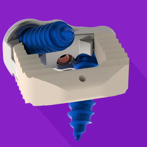 cervical interbody fusion cage