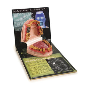 denture model / tongue / pathological / drug addiction
