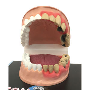 mouth anatomical model