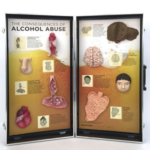 alcohol awareness anatomical model