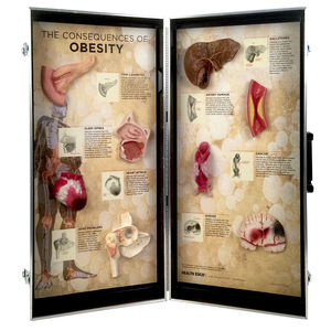 bariatric anatomical model