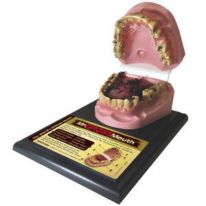 smokeless tobacco anatomical model