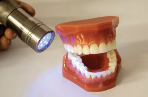 dental health awareness anatomical model