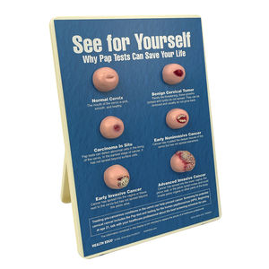 cervix model